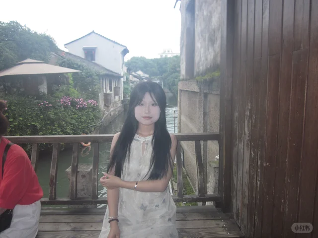 方圆脸打了瘦脸一年多的变化