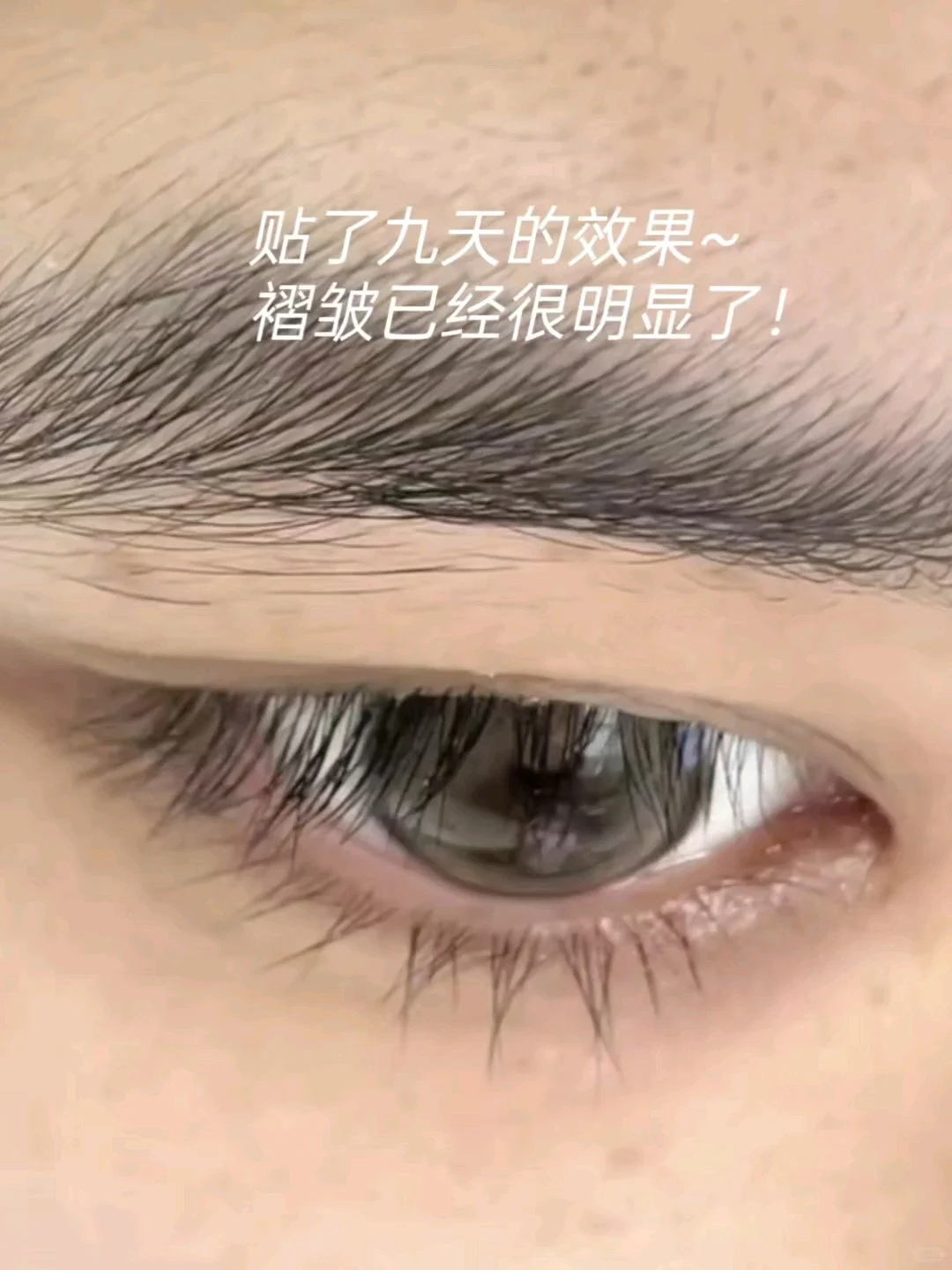 为什么眼头👍🏻双眼皮折不进去啊❗