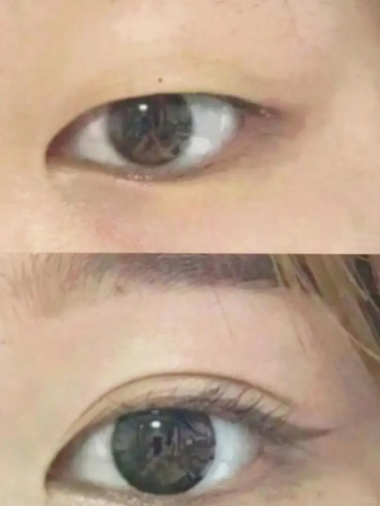 为什么眼头👍🏻双眼皮折不进去啊❗