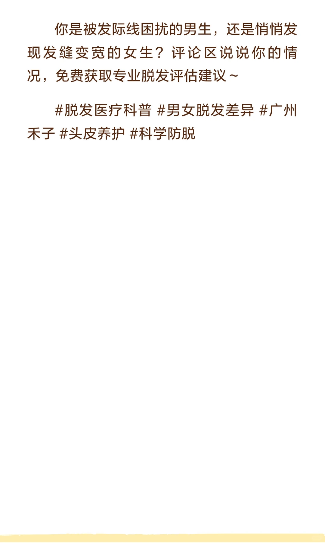 为什么脱发总觉得男生比女生多？医疗视角拆