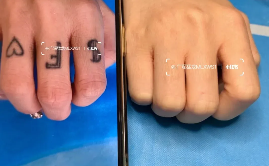 谁能告诉我这是什么意思洗过纹身的朋友们