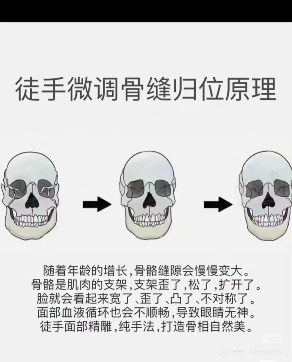 什么是徒手面部骨雕？真的有用吗？
