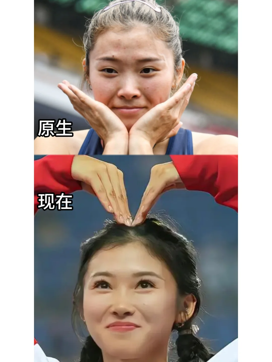 她只是Do了双眼皮，变化居然这么大！