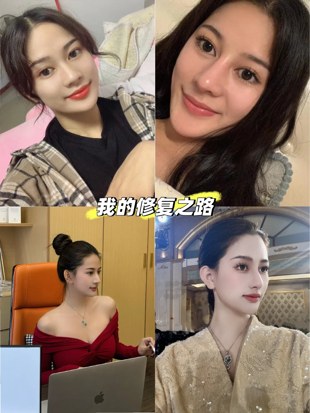 做过两次鼻子的我太有发言权了