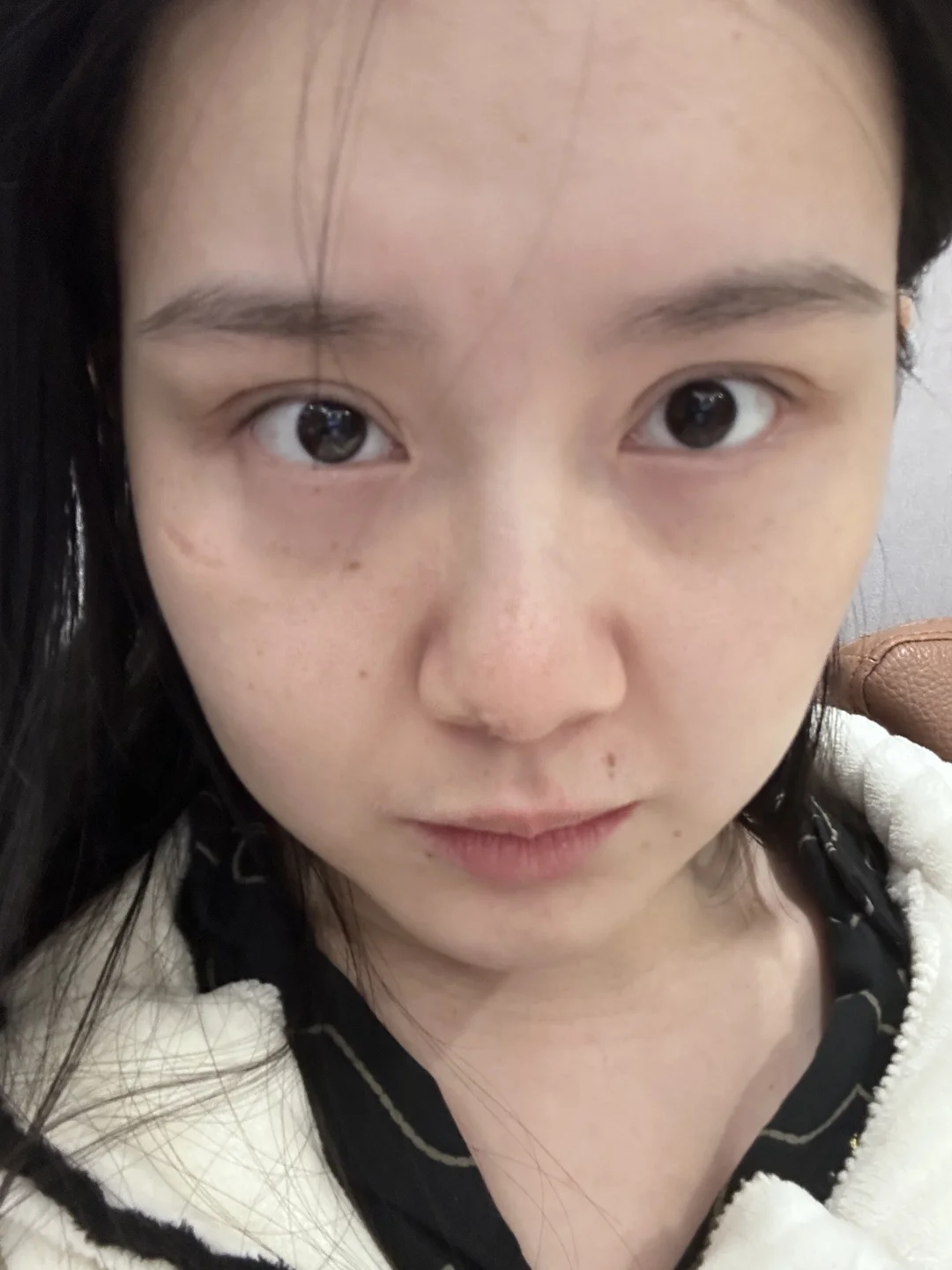 此生最后悔做了的整形项目