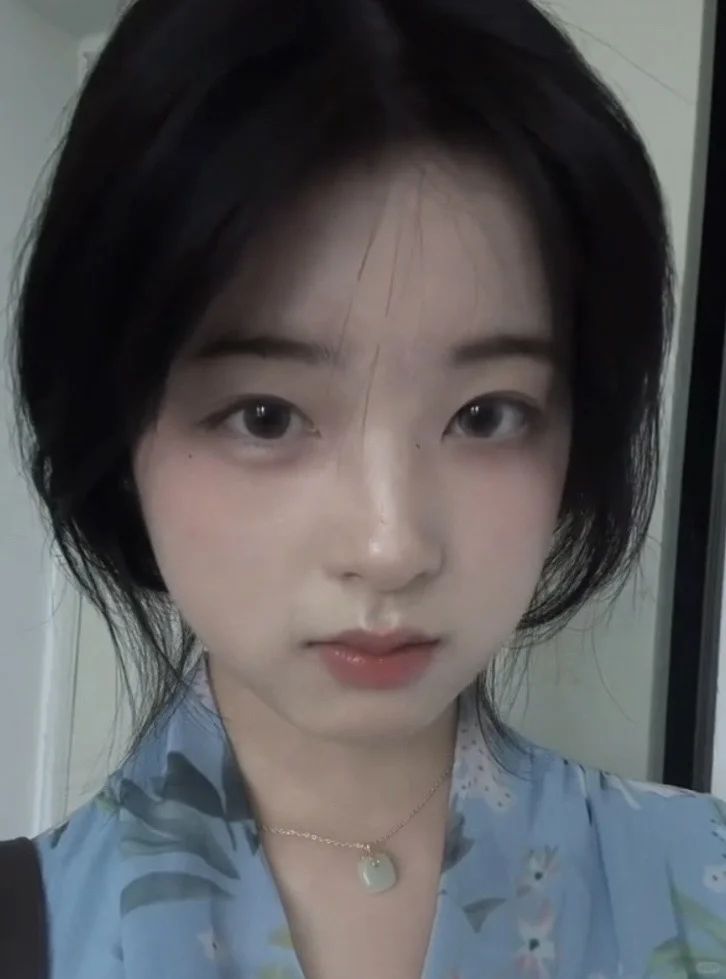 只能卸掉的法令纹和唇周的积线终于没了……