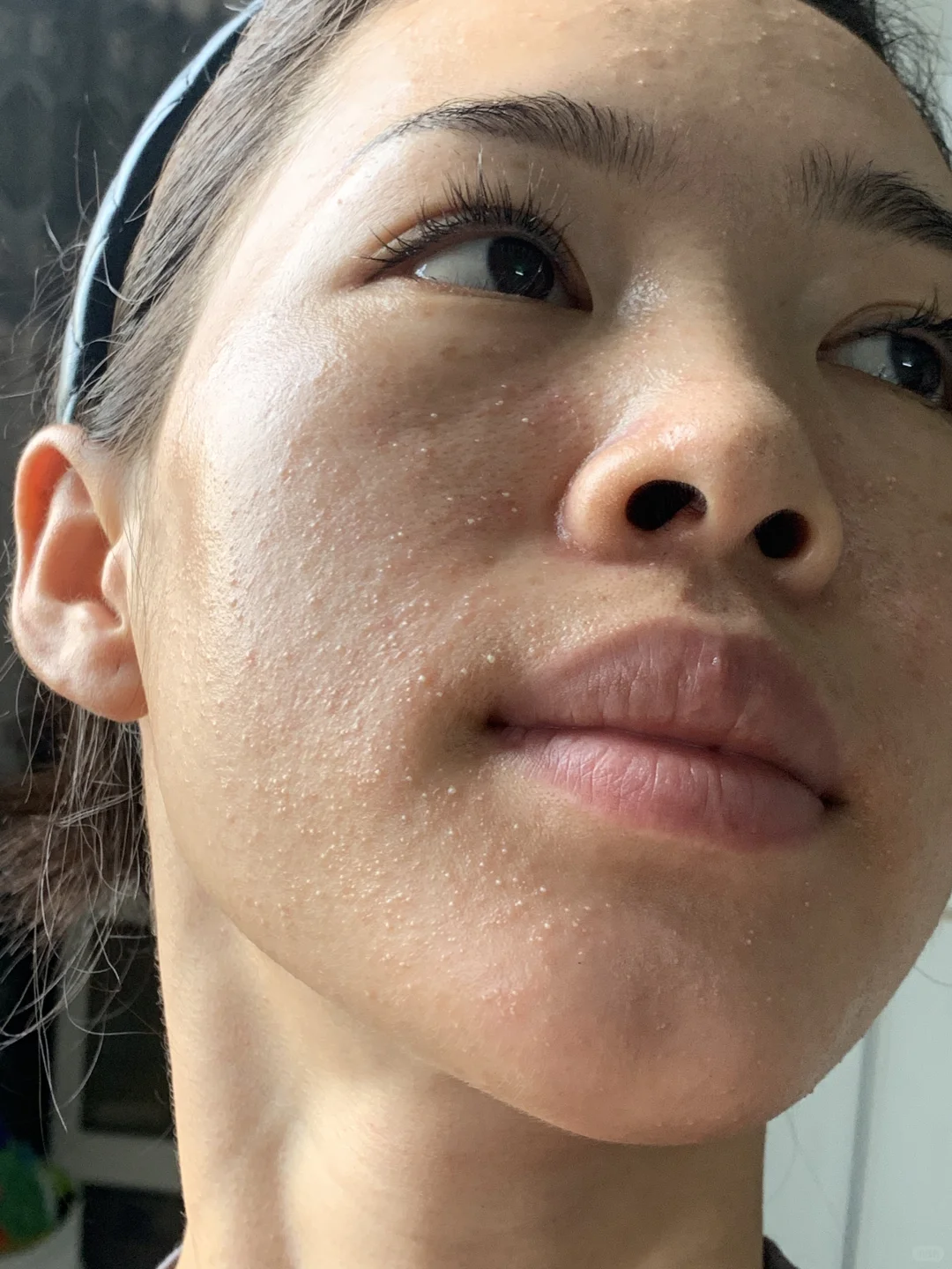 我给你10W.只要你能把这张脸𝐗𝐢𝐮 好？