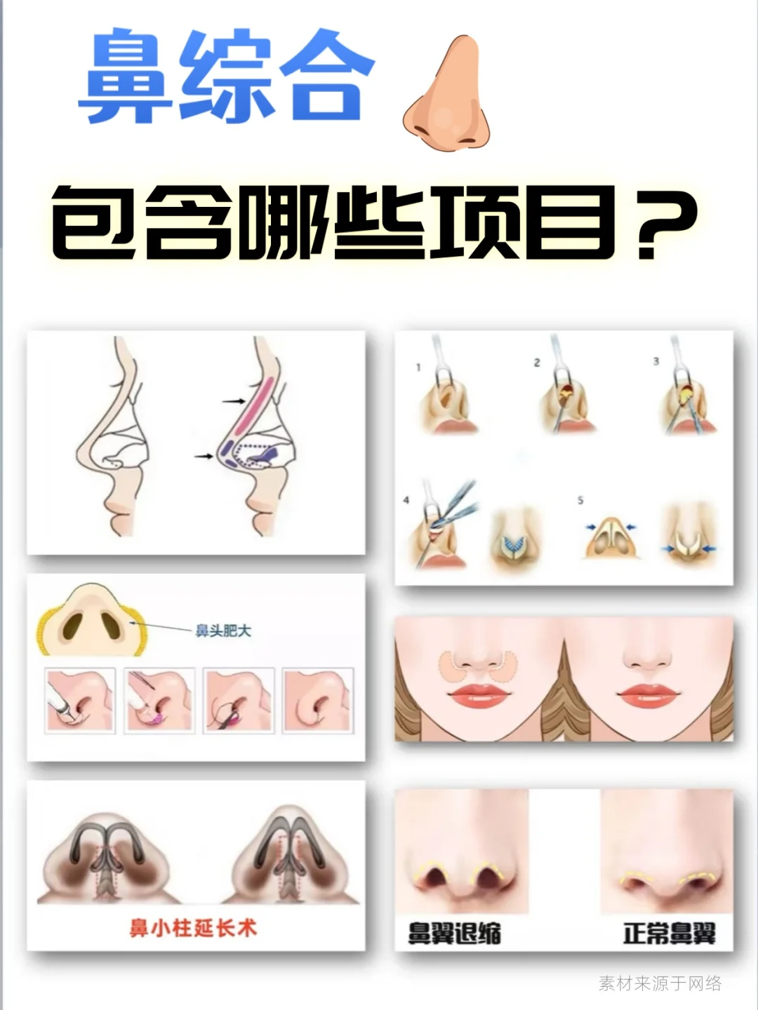 鼻综合包含哪些项目？这组图文带你搞清楚！