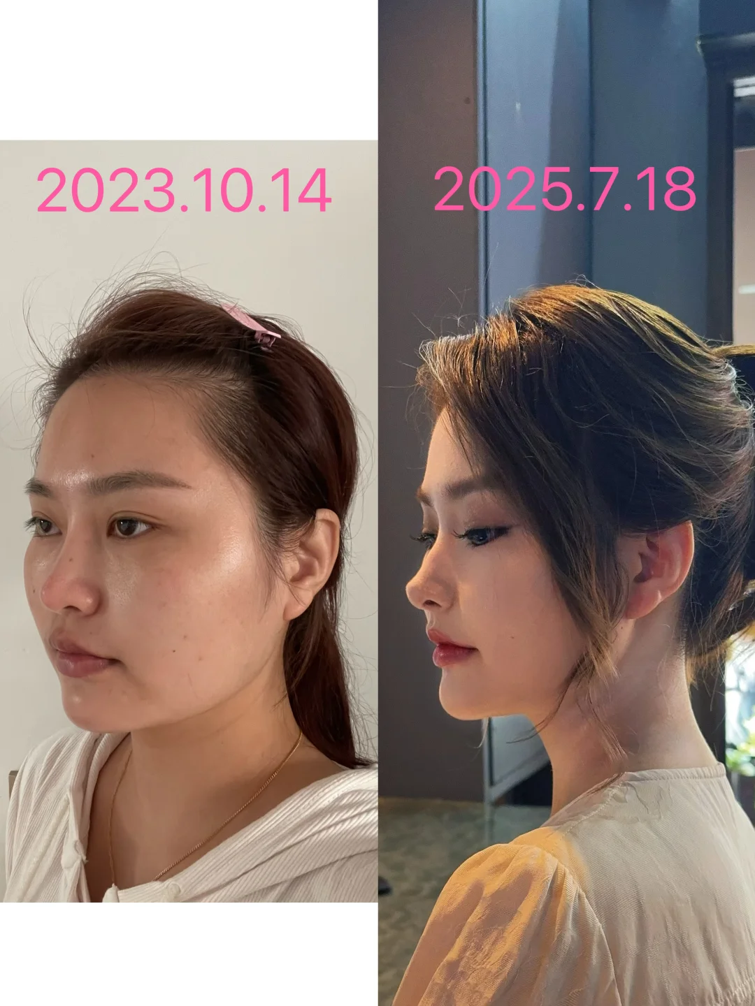 朋友说我直接换头了