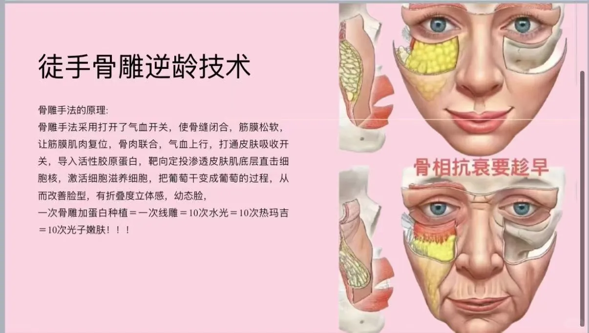 什么是徒手面部骨雕？真的有用吗？