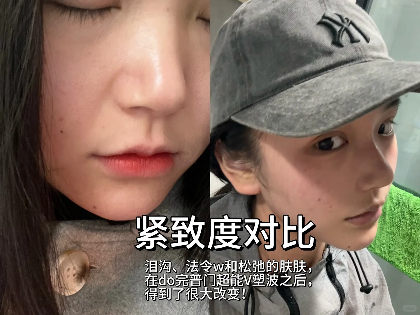 5分长相do成8分（泡感脸蛋可以直接参考）