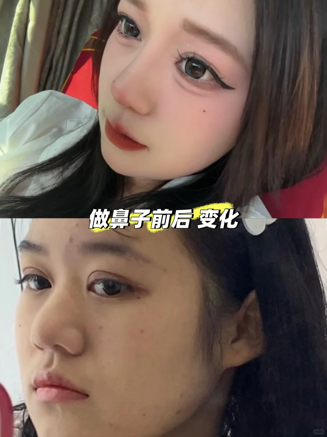 好喜欢我的新眼珠子 喜欢我的鼻子 我满意