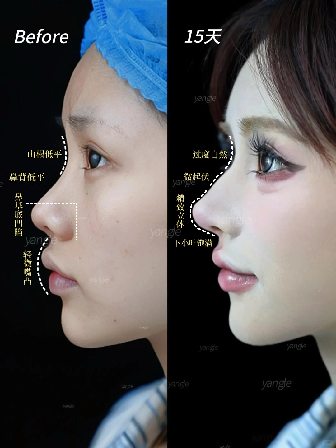 果然，鼻子才是颜值的基石！