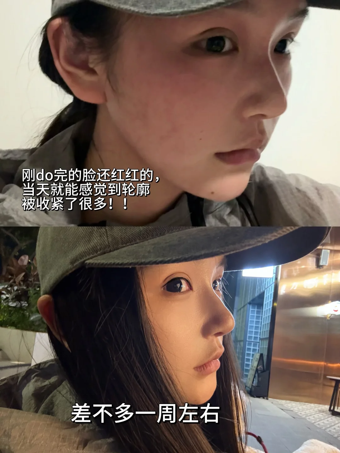 5分长相do成8分（泡感脸蛋可以直接参考）