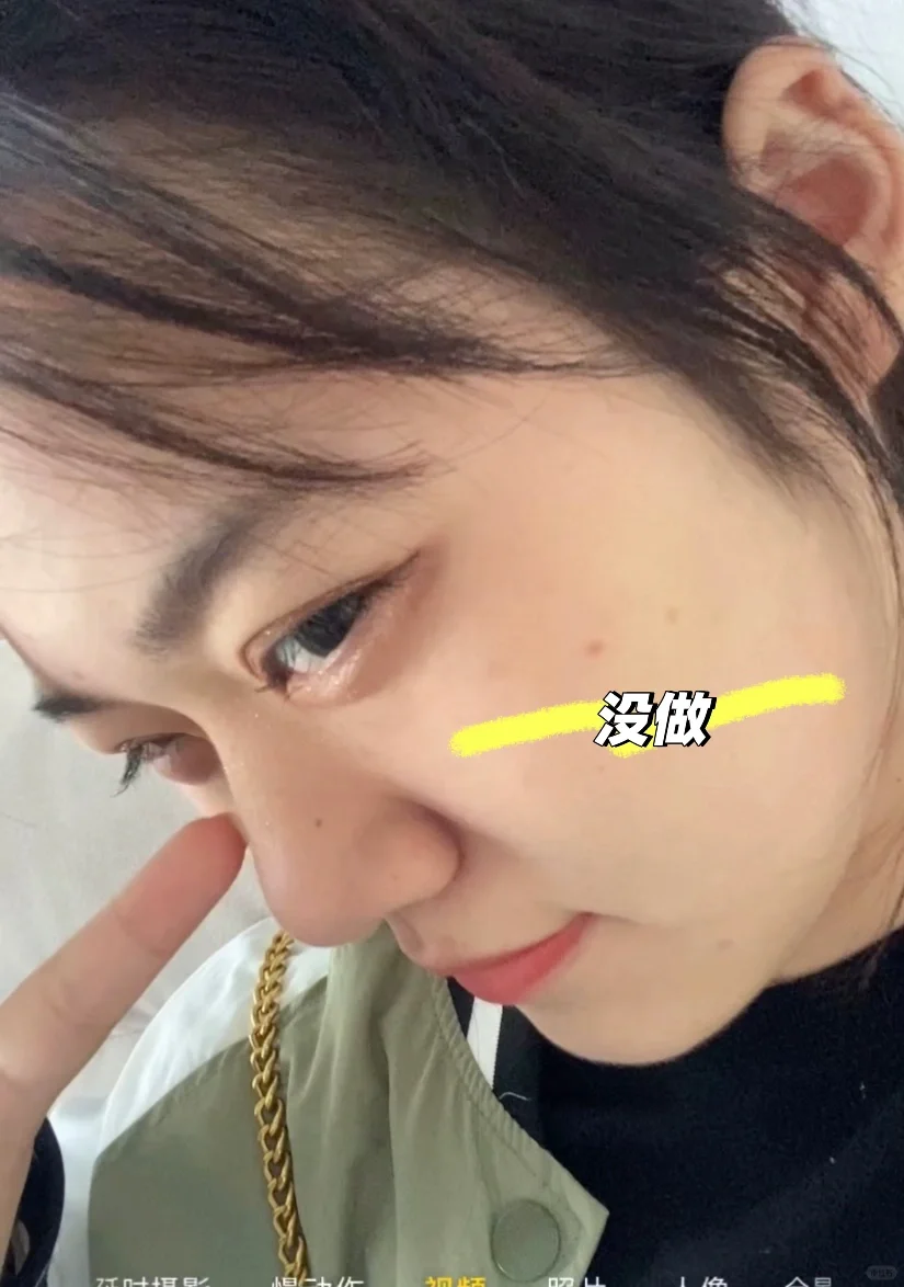 好喜欢我的新眼珠子 喜欢我的鼻子 我满意