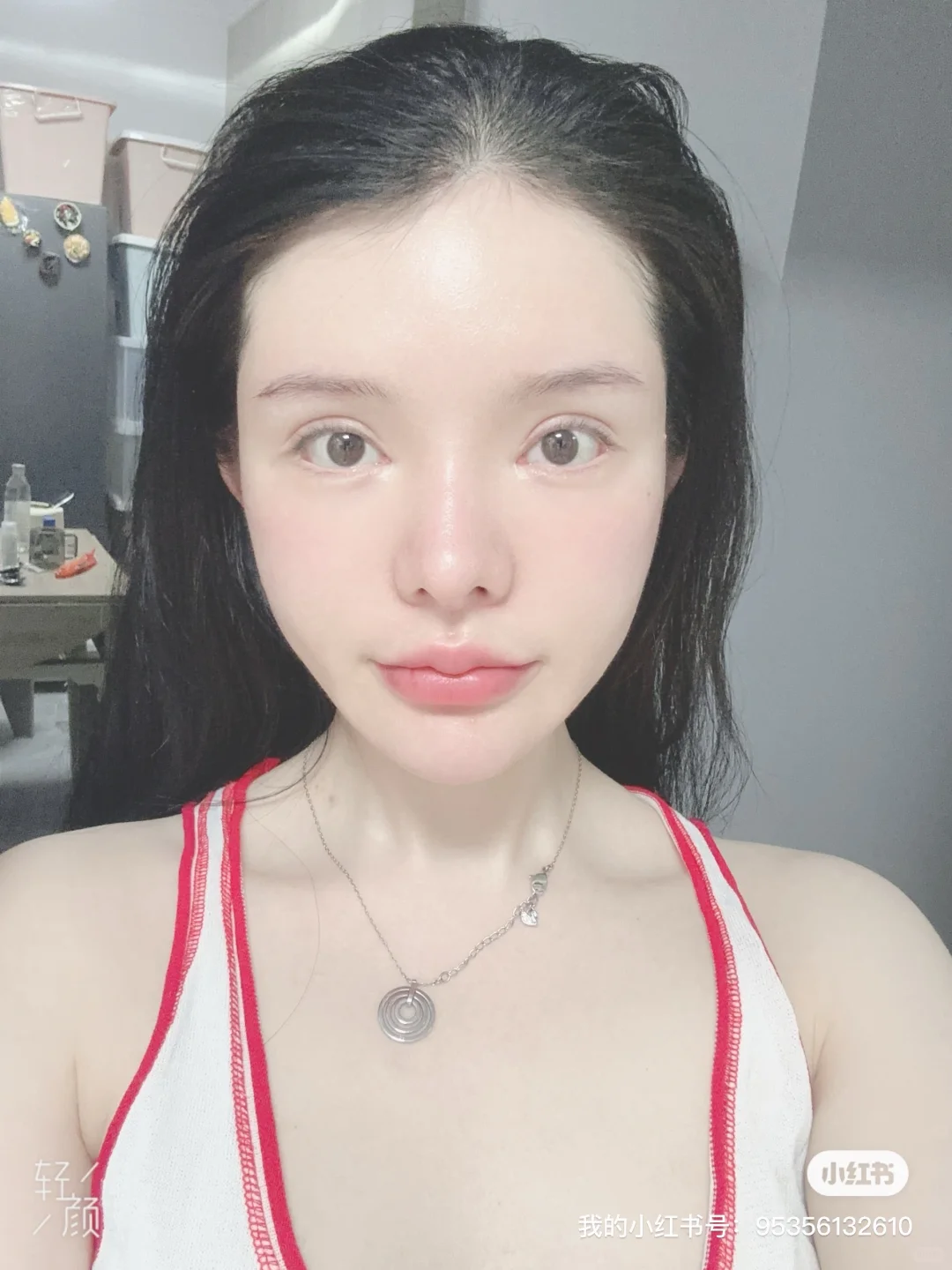 脂肪填充3次 把自己填成了一个球 上岸成功