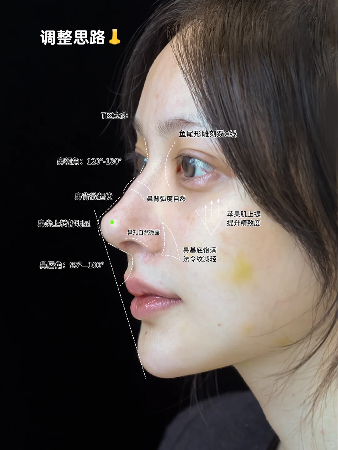 这个鼻型思路可以照搬了🤩