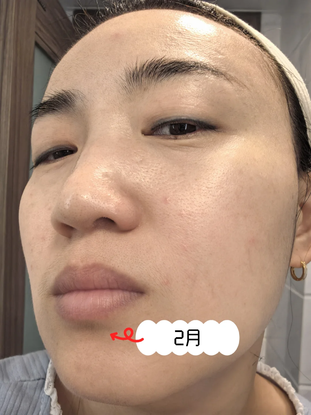 不敢整容，但换了张脸