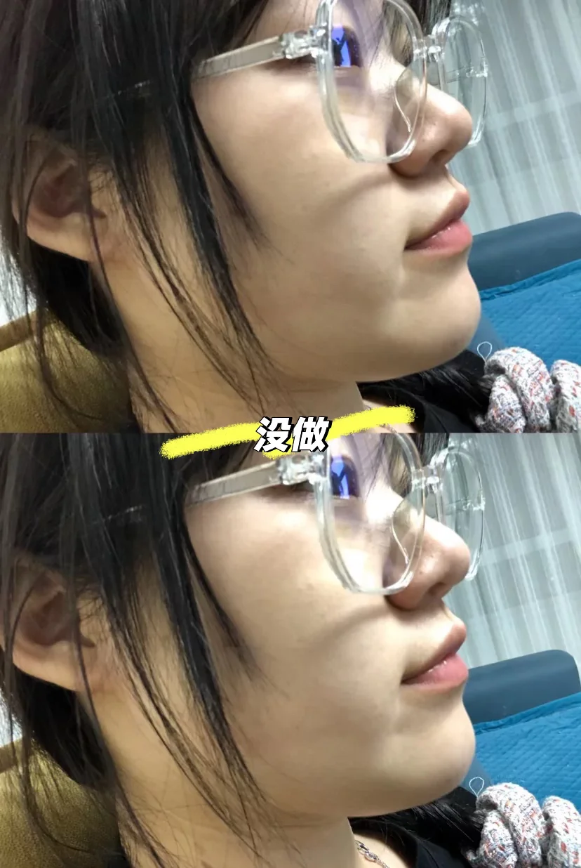 好喜欢我的新眼珠子 喜欢我的鼻子 我满意