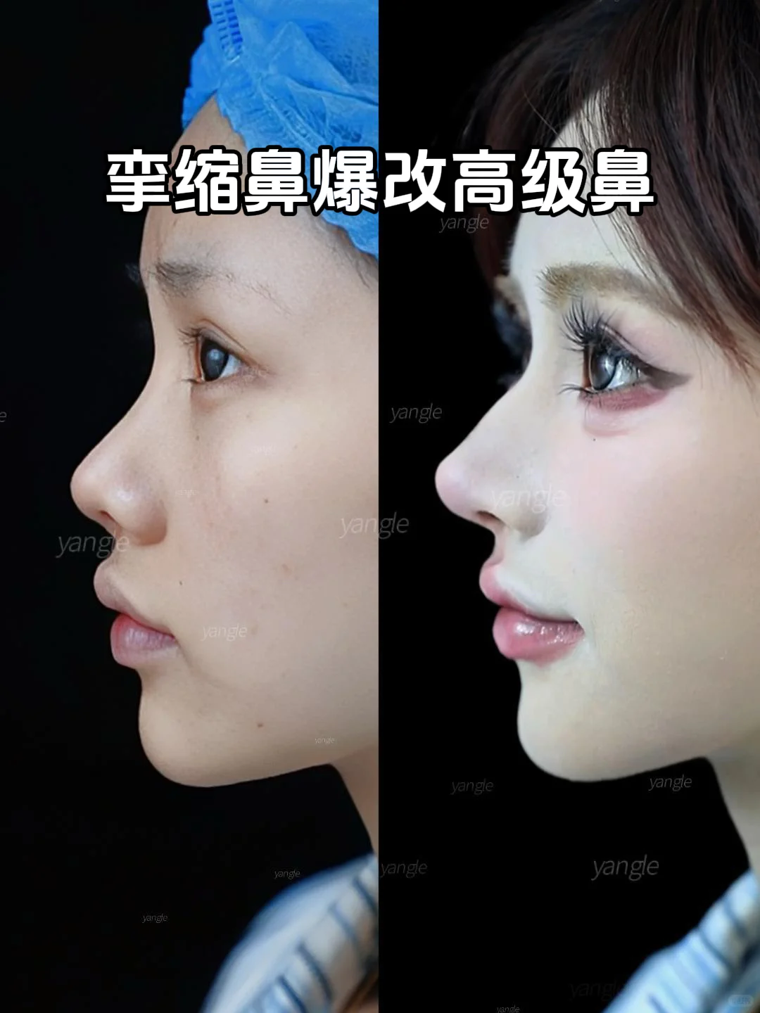 果然，鼻子才是颜值的基石！