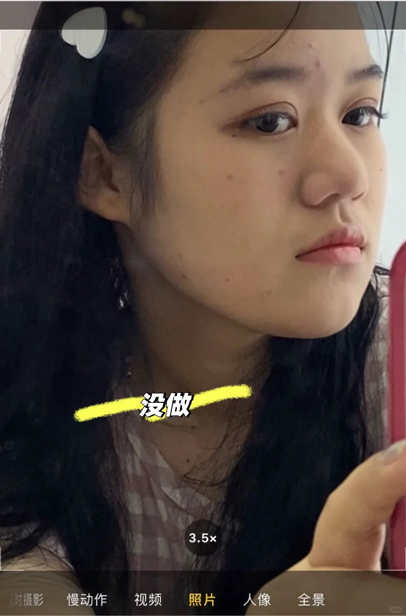 好喜欢我的新眼珠子 喜欢我的鼻子 我满意