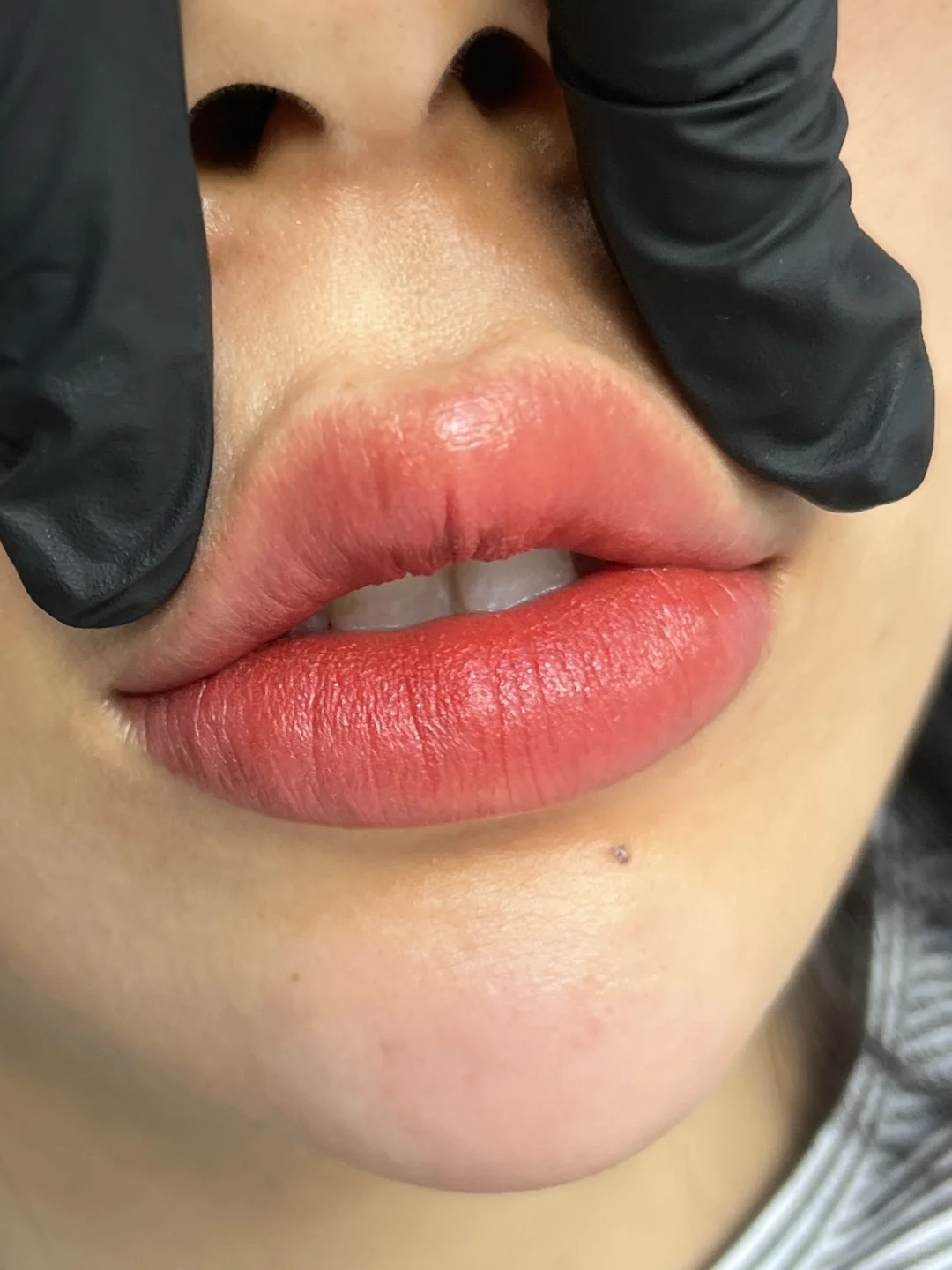 重塑病态唇美学