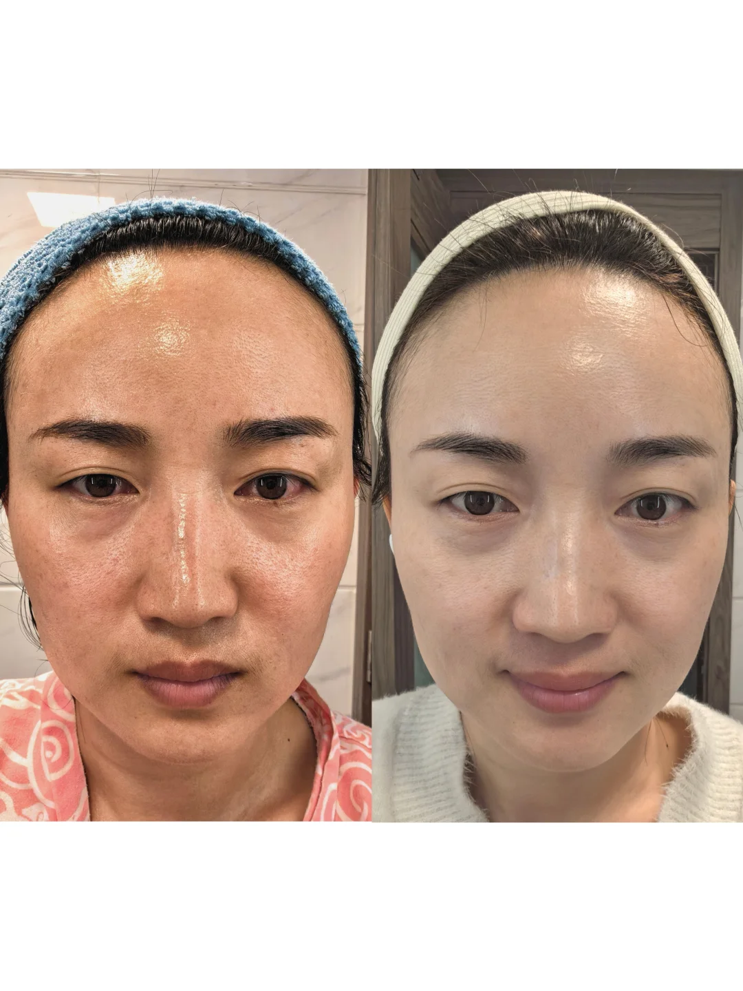 不敢整容，但换了张脸