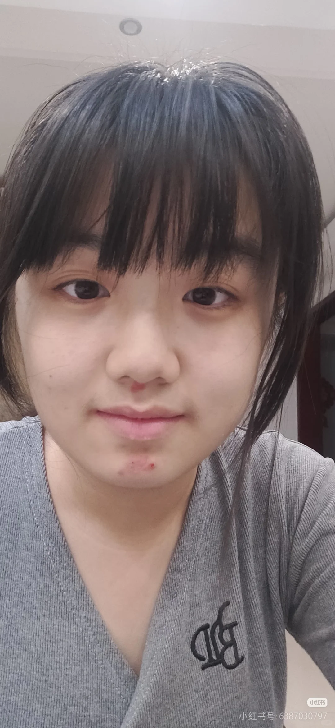 该整容还是该找到恋丑癖