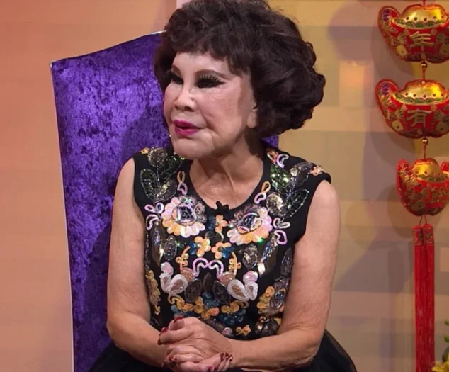 最早整容的一批，现在怎么样了呢？