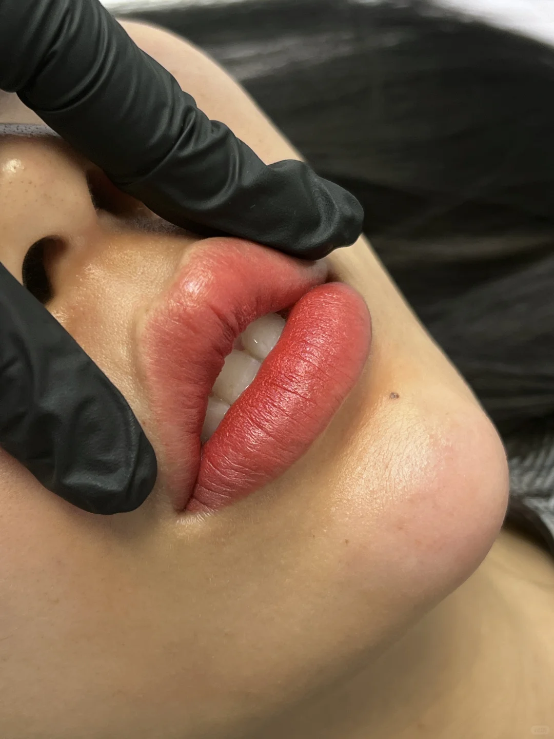 重塑病态唇美学