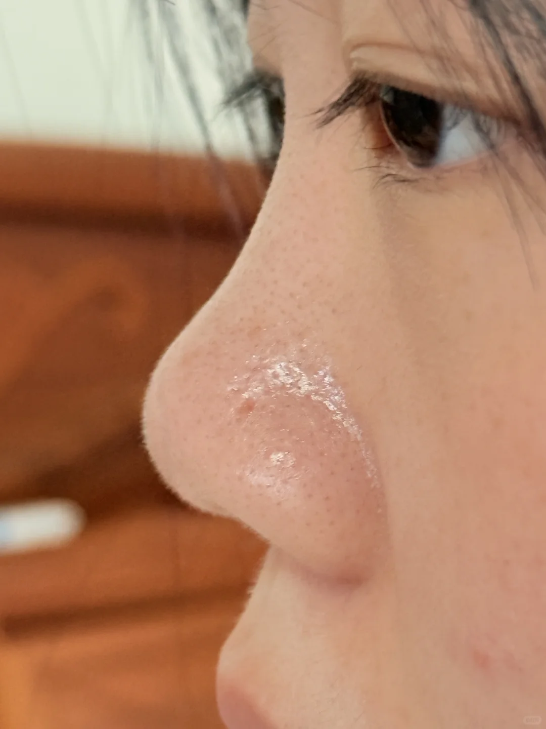 原生鼻很自卑建议do吗