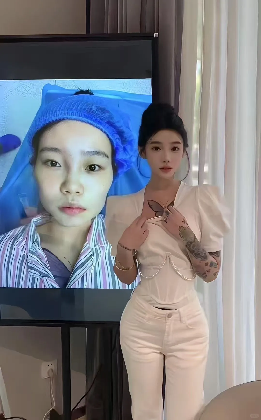 美到犯规的整容前整容后！！！