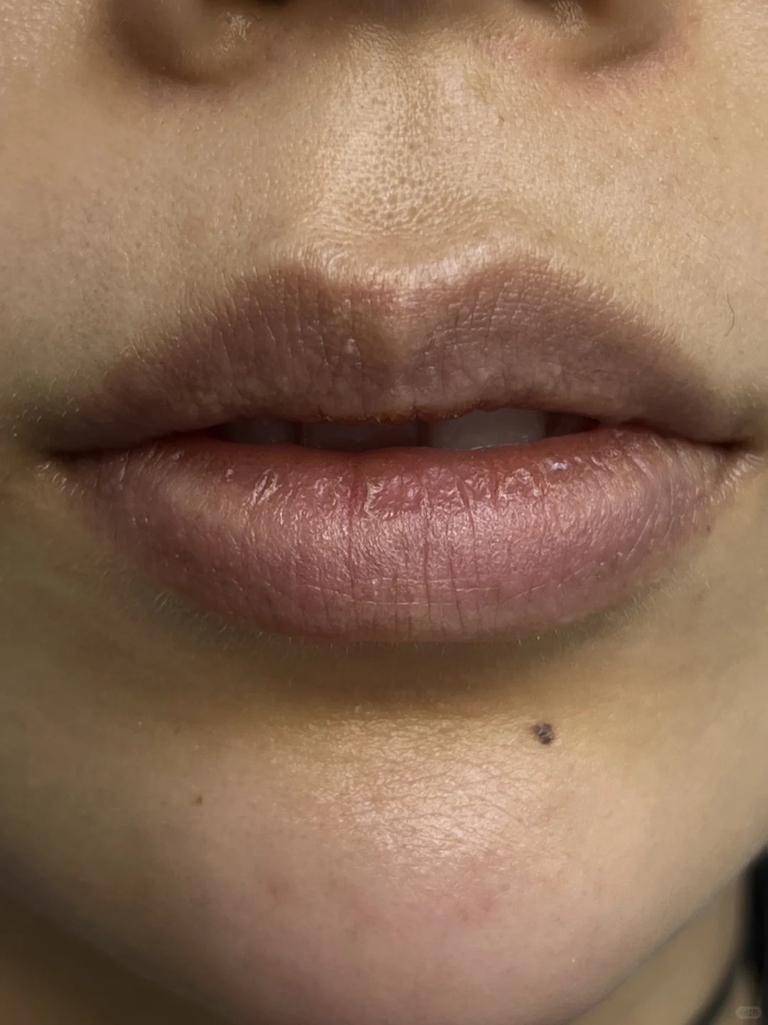 重塑病态唇美学