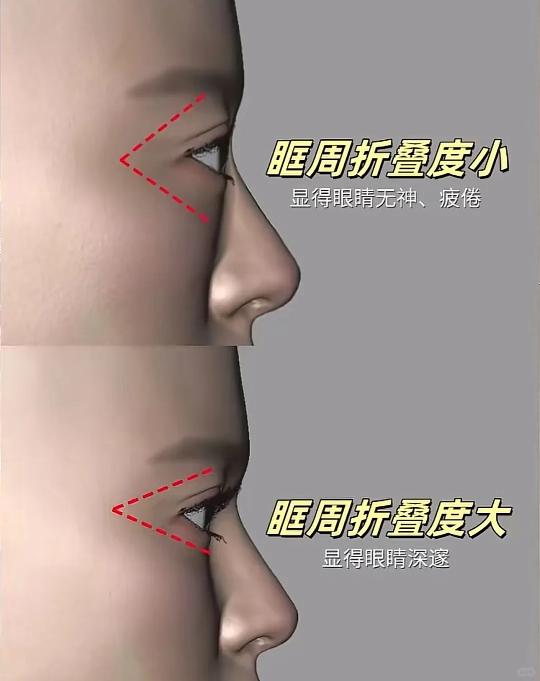 🇯🇵打了3次眉弓 雷区总结！！