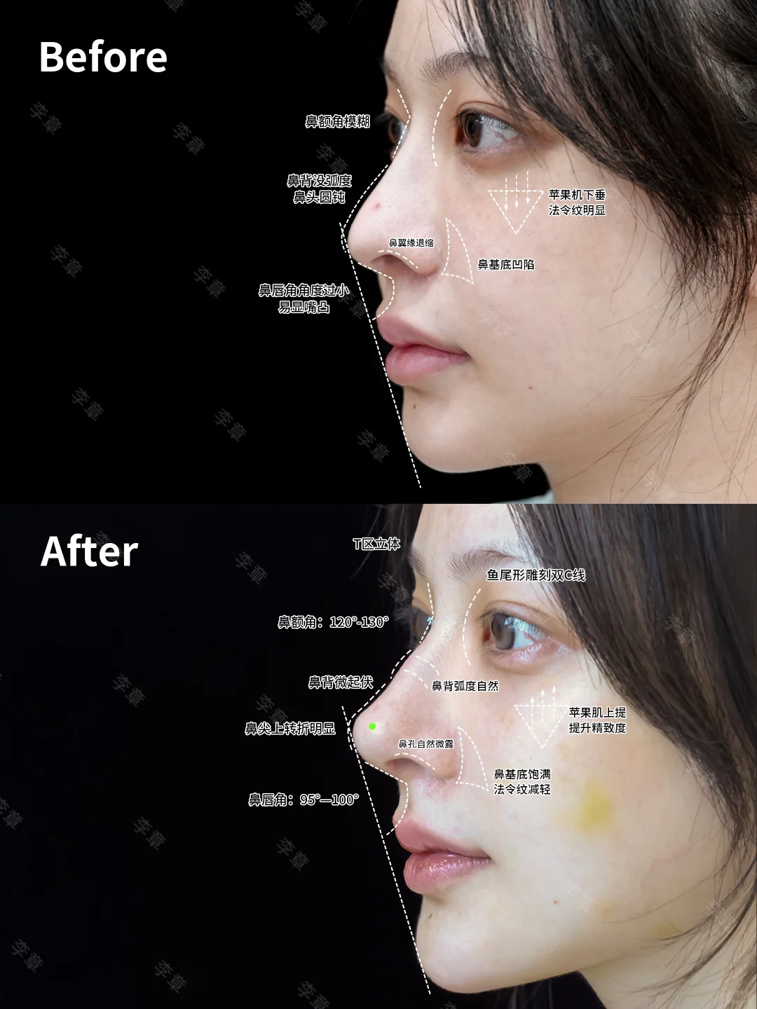 这个鼻型思路可以照搬了🤩