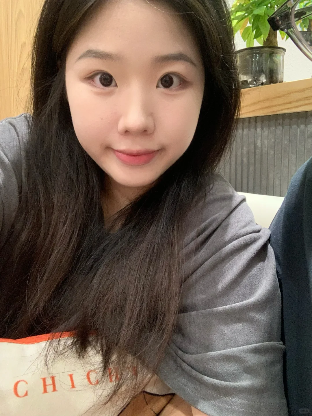 成都biu鼻基底两个月，咋还这么焦虑