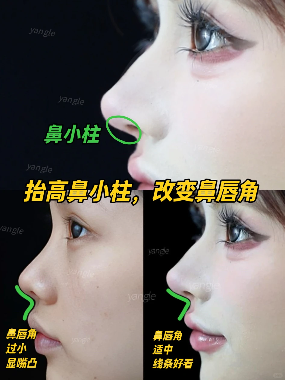 果然，鼻子才是颜值的基石！