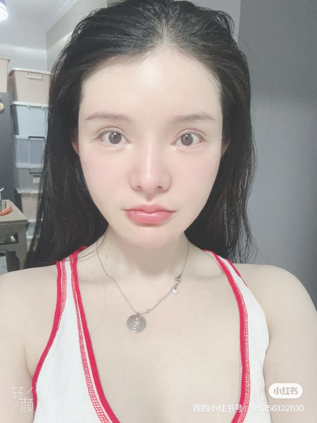 脂肪填充3次 把自己填成了一个球 上岸成功