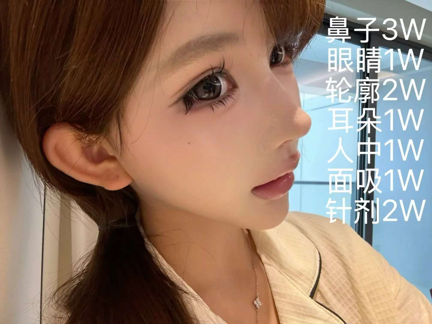 去武汉do了个鼻……花了3w值吗