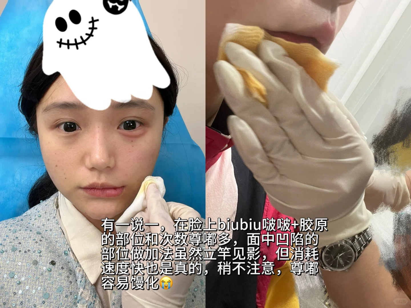 5分长相do成8分（泡感脸蛋可以直接参考）