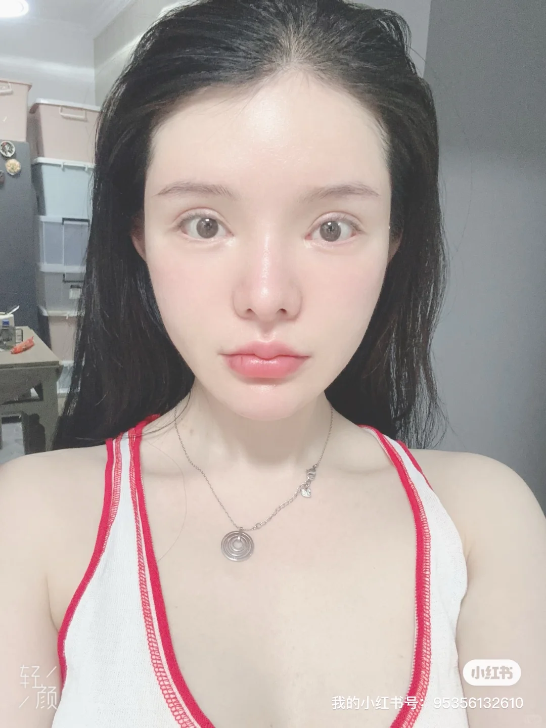 脂肪填充3次 把自己填成了一个球 上岸成功