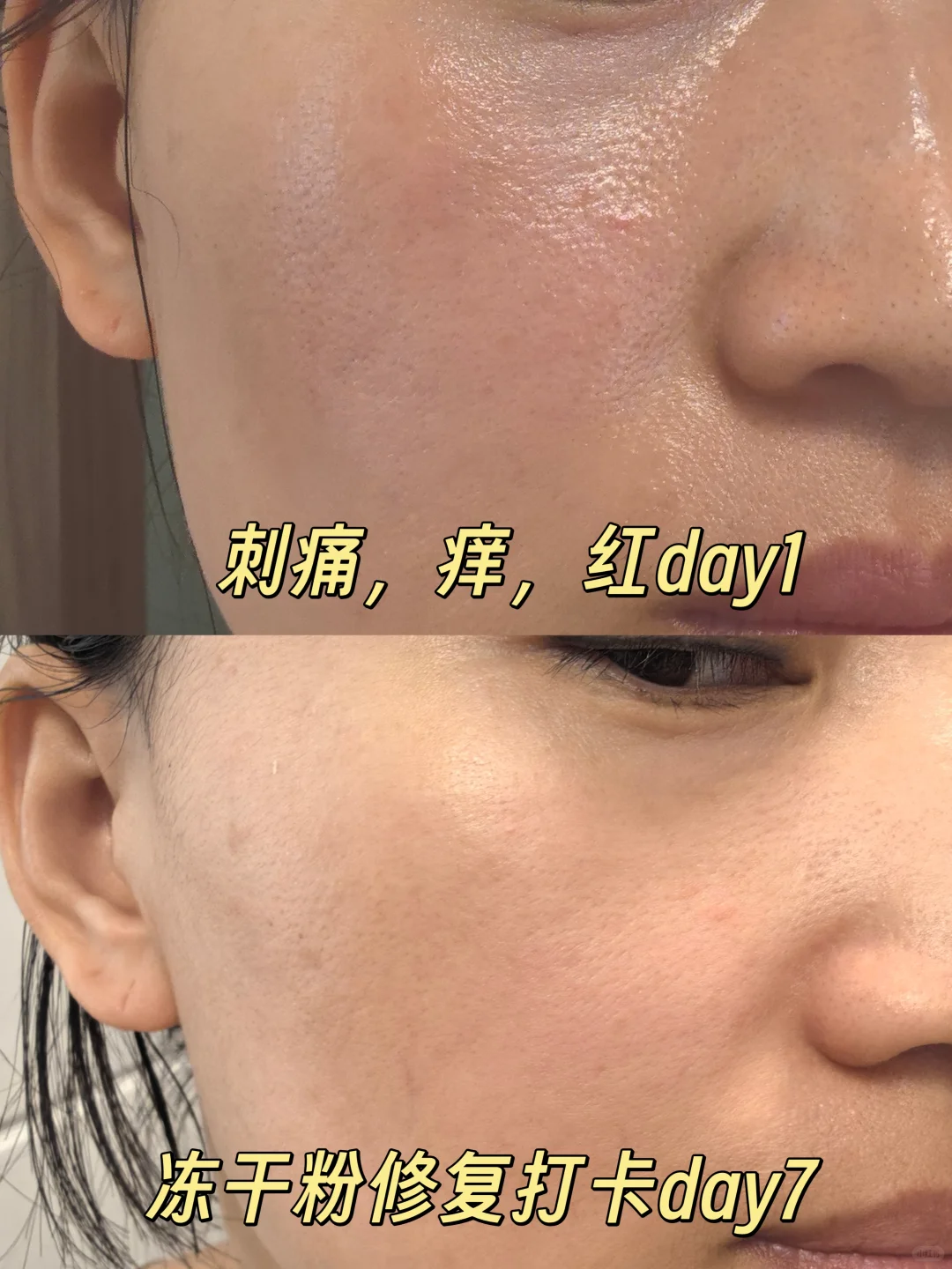 不敢整容，但换了张脸