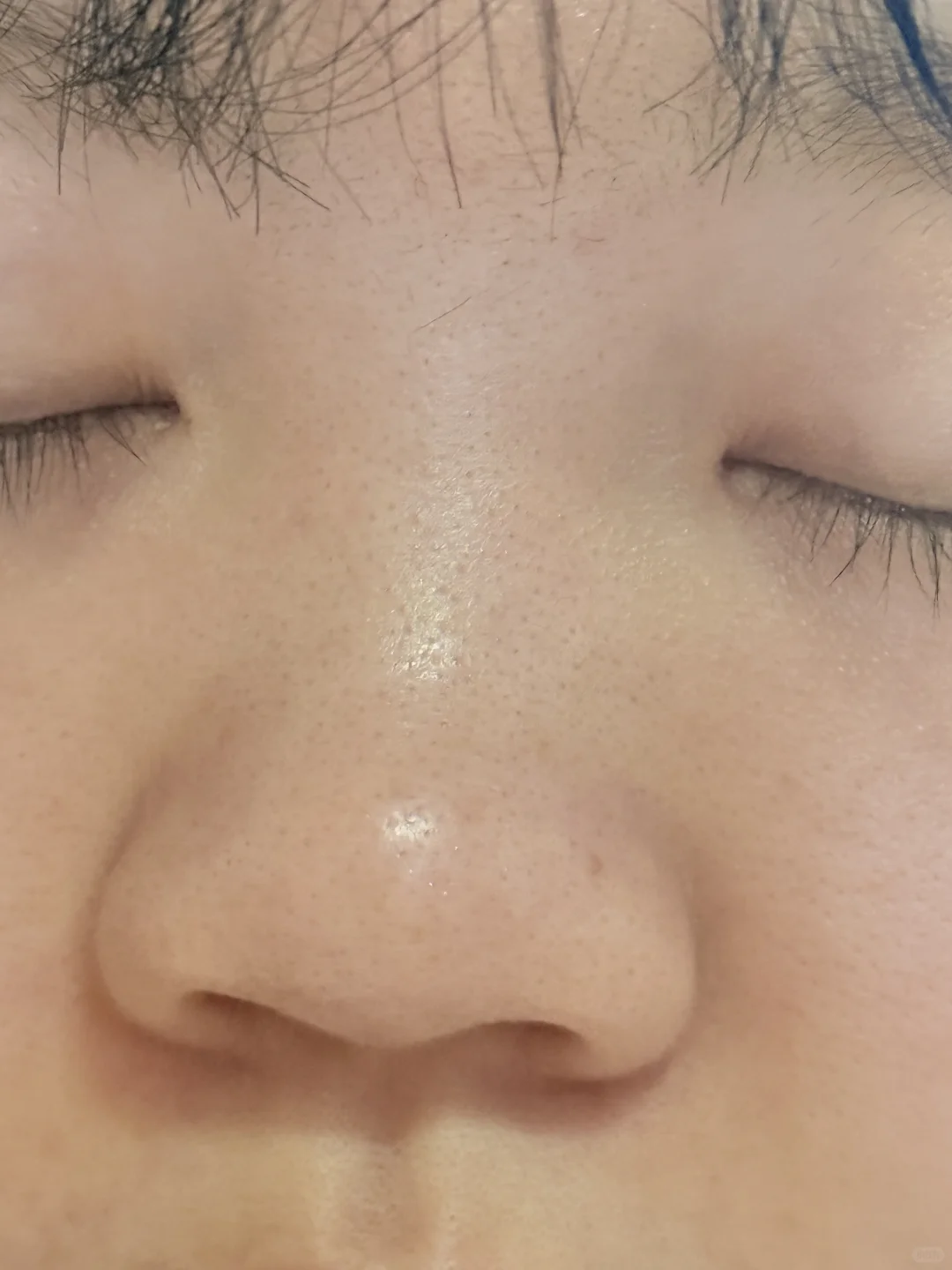 原生鼻很自卑建议do吗