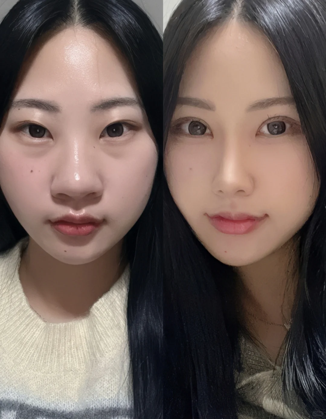 3W爆改的蒜头鼻，来评价一下，不玻璃心