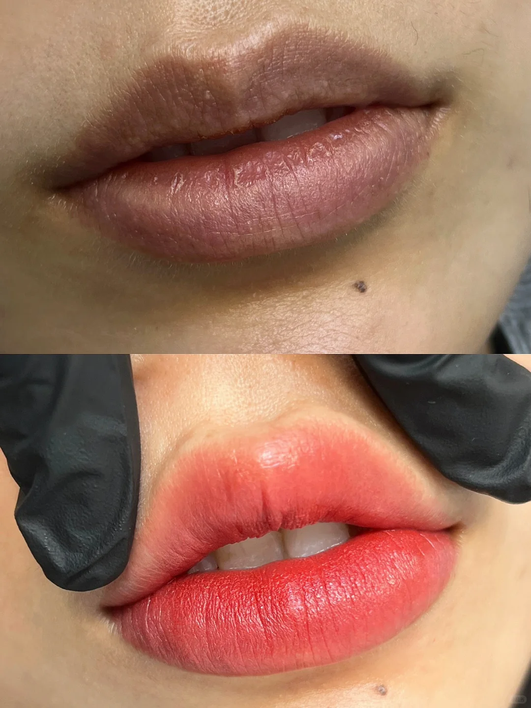 重塑病态唇美学