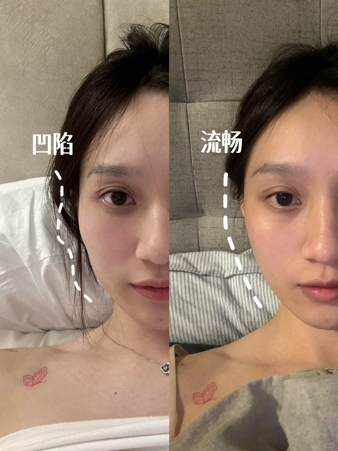 🇲🇾脸不凹了的第15天｜素人变美get！