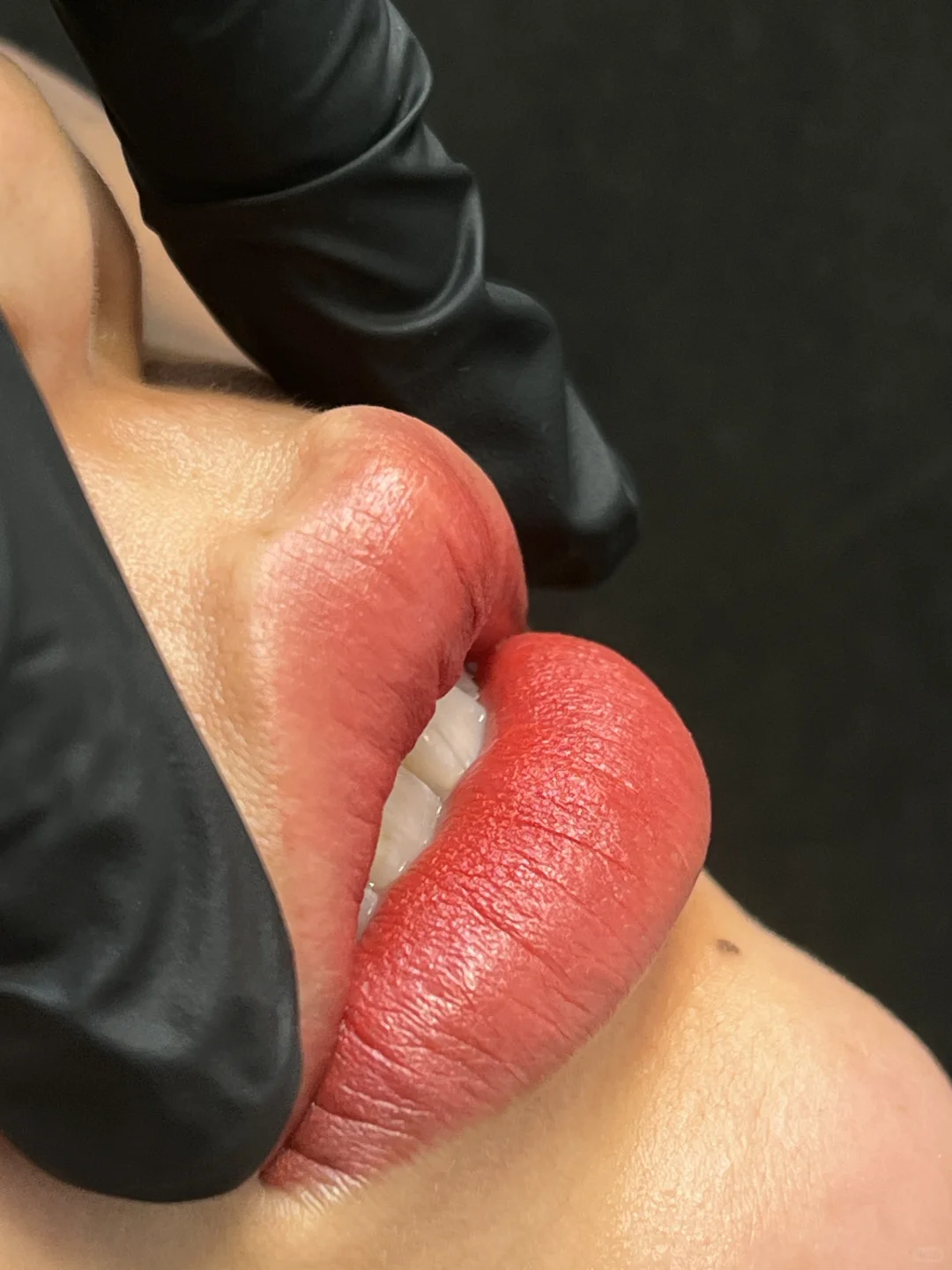 重塑病态唇美学