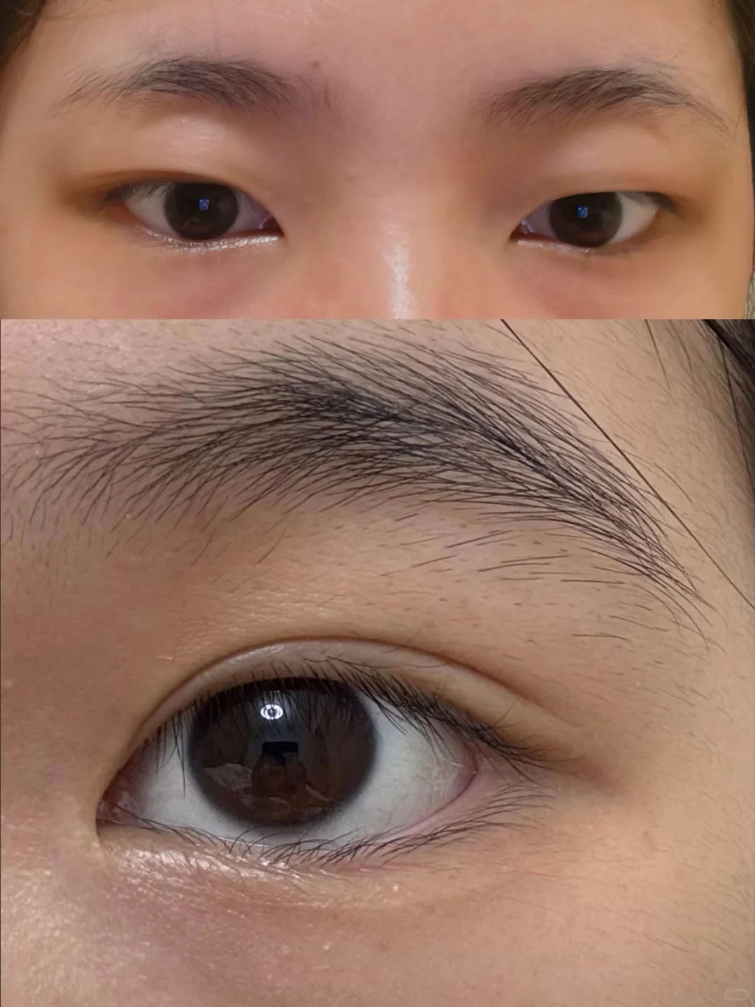 肿眼泡能上岸吗？