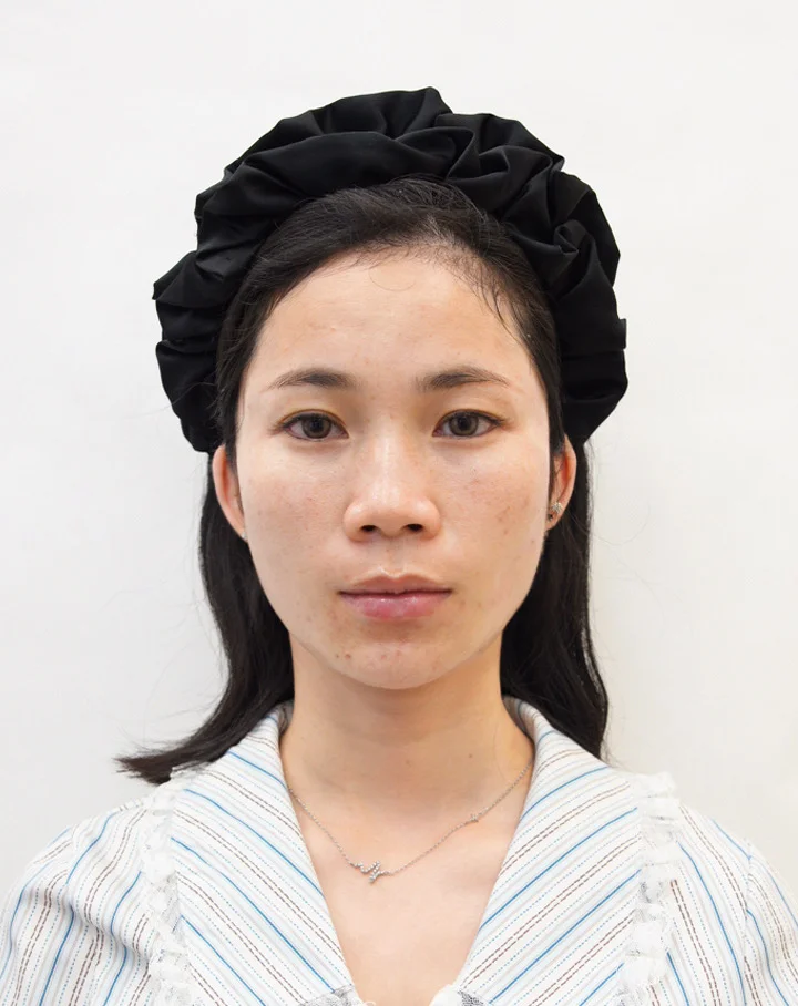 普通人打完啵啵三个月变化，算自救成功吗？