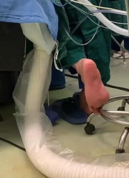 手术室的脚丫子